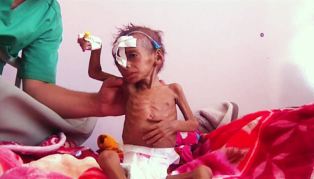 yemen 2